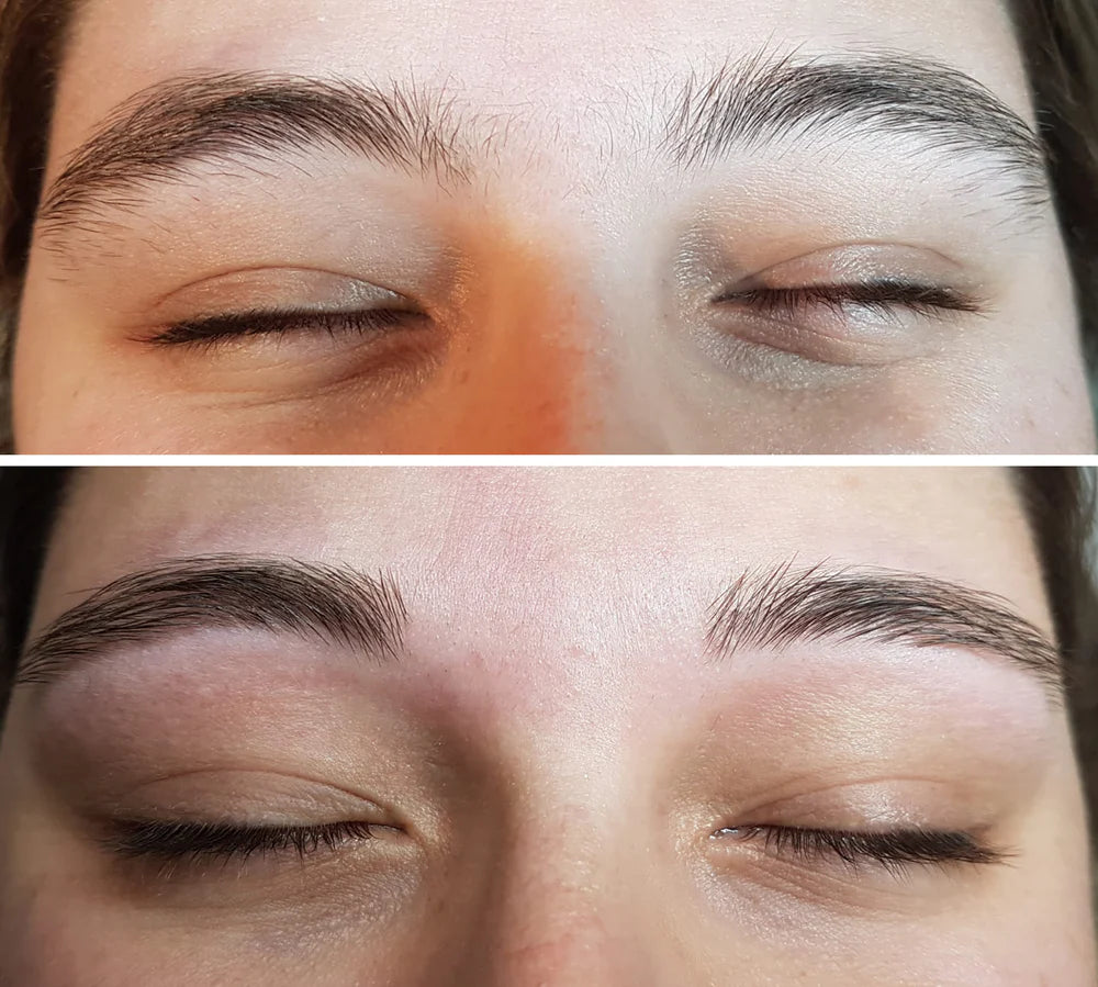 Sourcils — avant et après